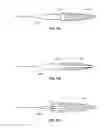 Fig. 17 - Methods for restoring blood flow within blocked vasculature