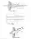 Fig. 35 - Methods and systems for performing a medical procedure