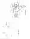 Fig. 72 - Methods and systems for performing a medical procedure