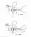 Fig. 97 - Methods and systems for performing a medical procedure