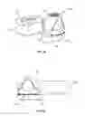 Fig. 25 - SPINAL IMPLANT SYSTEM AND METHOD