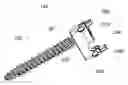 Fig. 01 - Polyaxial pedicle screw