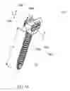 Fig. 02 - Polyaxial pedicle screw