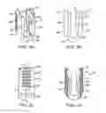 Fig. 04 - Interspinous spacer
