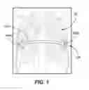 Fig. 02 - Pectus bar and stabilizer devices and methods