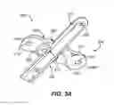 Fig. 04 - Pectus bar and stabilizer devices and methods