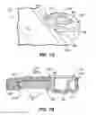 Fig. 09 - Pectus bar and stabilizer devices and methods