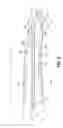 Fig. 06 - Split electrode for use in a bipolar electrosurgical instrument
