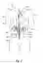 Fig. 03 - Methods for treating patients via renal neuromodulation