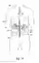 Fig. 09 - Methods for treating patients via renal neuromodulation