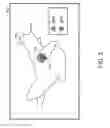 Fig. 03 - Determining ablation location using probabilistic decision-making