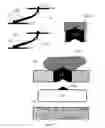 Fig. 04 - MEDICAL DEVICE COMPRISING A BALLOON-STENT ASSEMBLY AND METHODS OF USING THE SAME