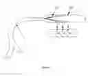 Fig. 09 - MEDICAL DEVICE COMPRISING A BALLOON-STENT ASSEMBLY AND METHODS OF USING THE SAME