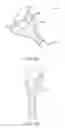 Fig. 12 - Basket and everting balloon with simplified design and control