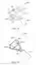 Fig. 13 - Basket and everting balloon with simplified design and control