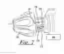 Fig. 04 - BLADE POSITIONING DEVICE