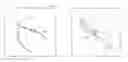 Fig. 01 - SYSTEM AND METHOD FOR DELIVERING A STENT TO A SELECTED POSITION WITHIN A LUMEN