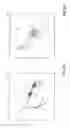Fig. 04 - SYSTEM AND METHOD FOR DELIVERING A STENT TO A SELECTED POSITION WITHIN A LUMEN
