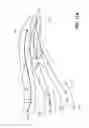 Fig. 15 - SYSTEM AND METHOD FOR DELIVERING A STENT TO A SELECTED POSITION WITHIN A LUMEN