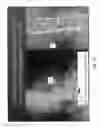Fig. 28 - METHODS AND APPARATUS FOR SPINAL RECONSTRUCTIVE SURGERY AND MEASURING SPINAL LENGTH AND INTERVERTEBRAL SPACING, TENSION AND ROTATION