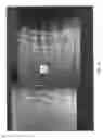 Fig. 33 - METHODS AND APPARATUS FOR SPINAL RECONSTRUCTIVE SURGERY AND MEASURING SPINAL LENGTH AND INTERVERTEBRAL SPACING, TENSION AND ROTATION