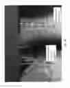 Fig. 35 - METHODS AND APPARATUS FOR SPINAL RECONSTRUCTIVE SURGERY AND MEASURING SPINAL LENGTH AND INTERVERTEBRAL SPACING, TENSION AND ROTATION