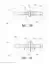 Fig. 08 - Methods of cleaning endotracheal tubes including light treatment