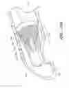 Fig. 35 - Methods of cleaning endotracheal tubes including light treatment