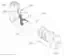 Fig. 01 - Method of manufacture of a dental prophy angle