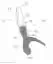 Fig. 03 - Method of manufacture of a dental prophy angle
