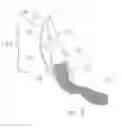 Fig. 04 - Method of manufacture of a dental prophy angle