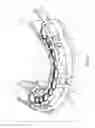 Fig. 04 - Anatomical adaptable drape device