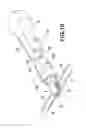 Fig. 09 - Tool for handling palatal expanders