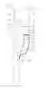 Fig. 01 - Bifurcated prosthesis with an internal limb