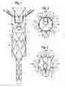 Fig. 02 - Bifurcated prosthesis with an internal limb