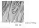 Fig. 16 - TISSUE-DERIVED SCAFFOLDS FOR CORNEAL RECONSTRUCTION