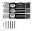Fig. 33 - TISSUE-DERIVED SCAFFOLDS FOR CORNEAL RECONSTRUCTION