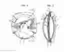Fig. 02 - MICROPATTERNED INTRAOCULAR IMPLANTS