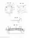 Fig. 08 - MICROPATTERNED INTRAOCULAR IMPLANTS