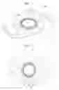 Fig. 02 - Adjustable intraocular lens