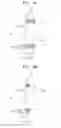 Fig. 04 - Adjustable intraocular lens