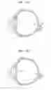 Fig. 13 - Adjustable intraocular lens