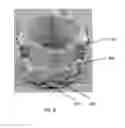 Fig. 09 - Decalcifying heart valve
