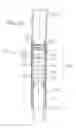 Fig. 11 - Steerable assembly for delivering a prosthetic heart valve