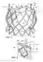 Fig. 02 - Methods of loading a prosthetic valve in a delivery apparatus