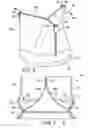 Fig. 06 - Methods of loading a prosthetic valve in a delivery apparatus