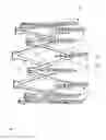 Fig. 04 - Implantable device and delivery system for reshaping a heart valve annulus