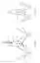 Fig. 09 - Implantable device and delivery system for reshaping a heart valve annulus