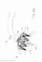 Fig. 22 - Implantable device and delivery system for reshaping a heart valve annulus