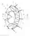 Fig. 44 - Implantable device and delivery system for reshaping a heart valve annulus